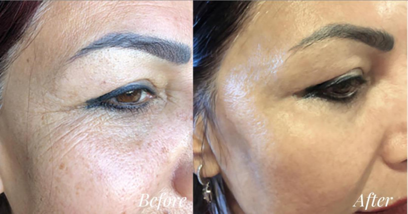 unprecedented-results-in-anti-aging-with-blue-scorpion-venom-product-big-1